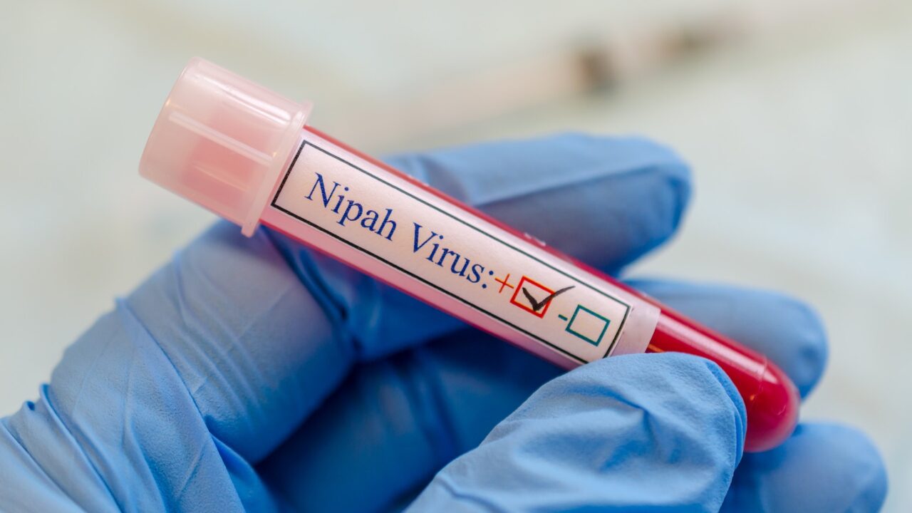 UTMB scientists develop a vaccine against Nipah virus