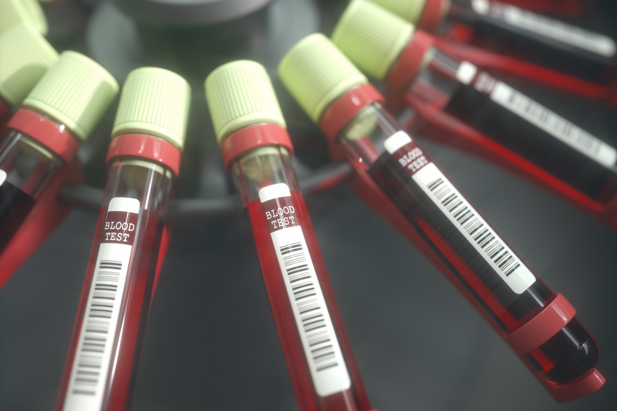 Blood test aids in predicting lung cancer mortality risk