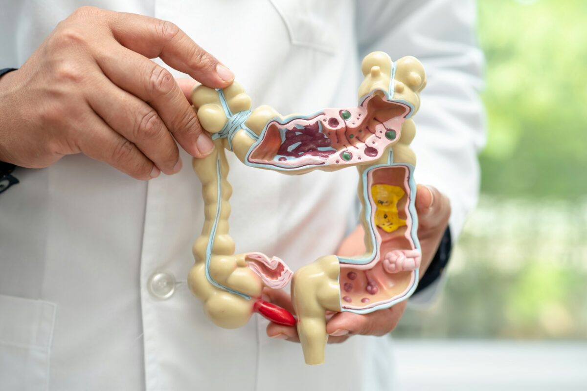 KRAS-targeting drugs show promise for rare appendix cancer