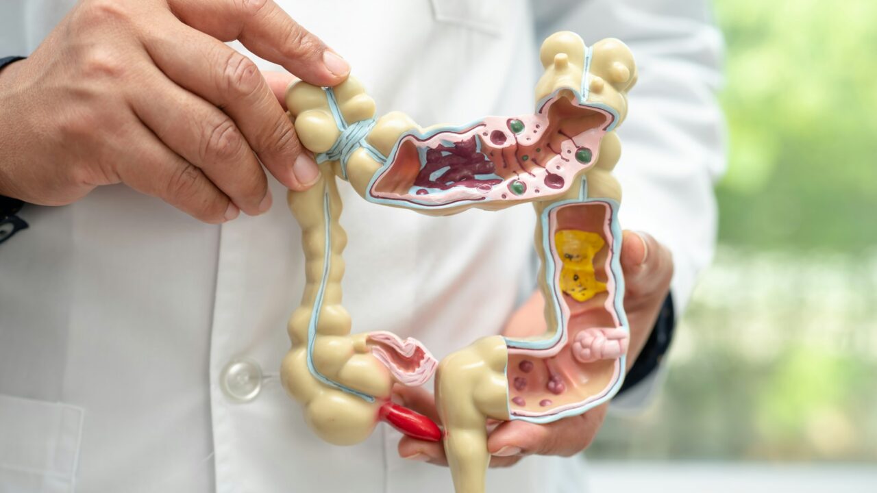 Changes in gut microbiome may influence cancer growth in other parts of the body