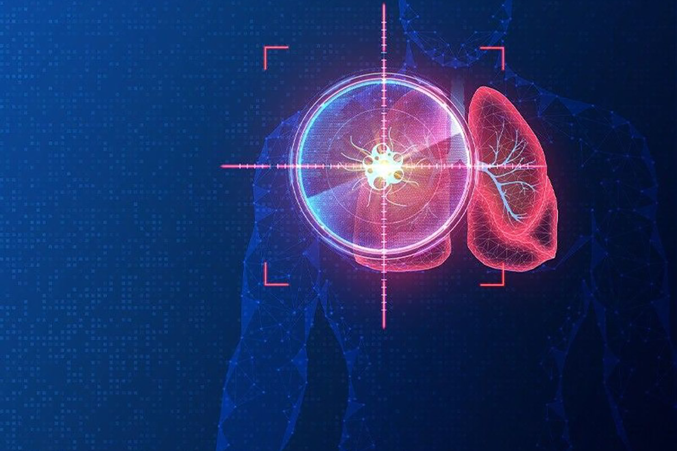 Cabozantinib demonstrates encouraging antitumor activity in rare cancers