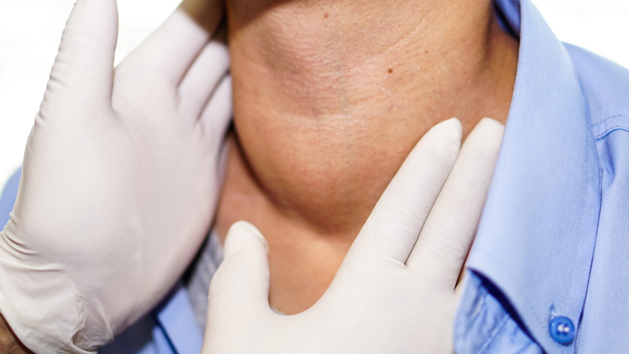 Definitive radiotherapy demonstrates effectiveness in metastatic thyroid cancers