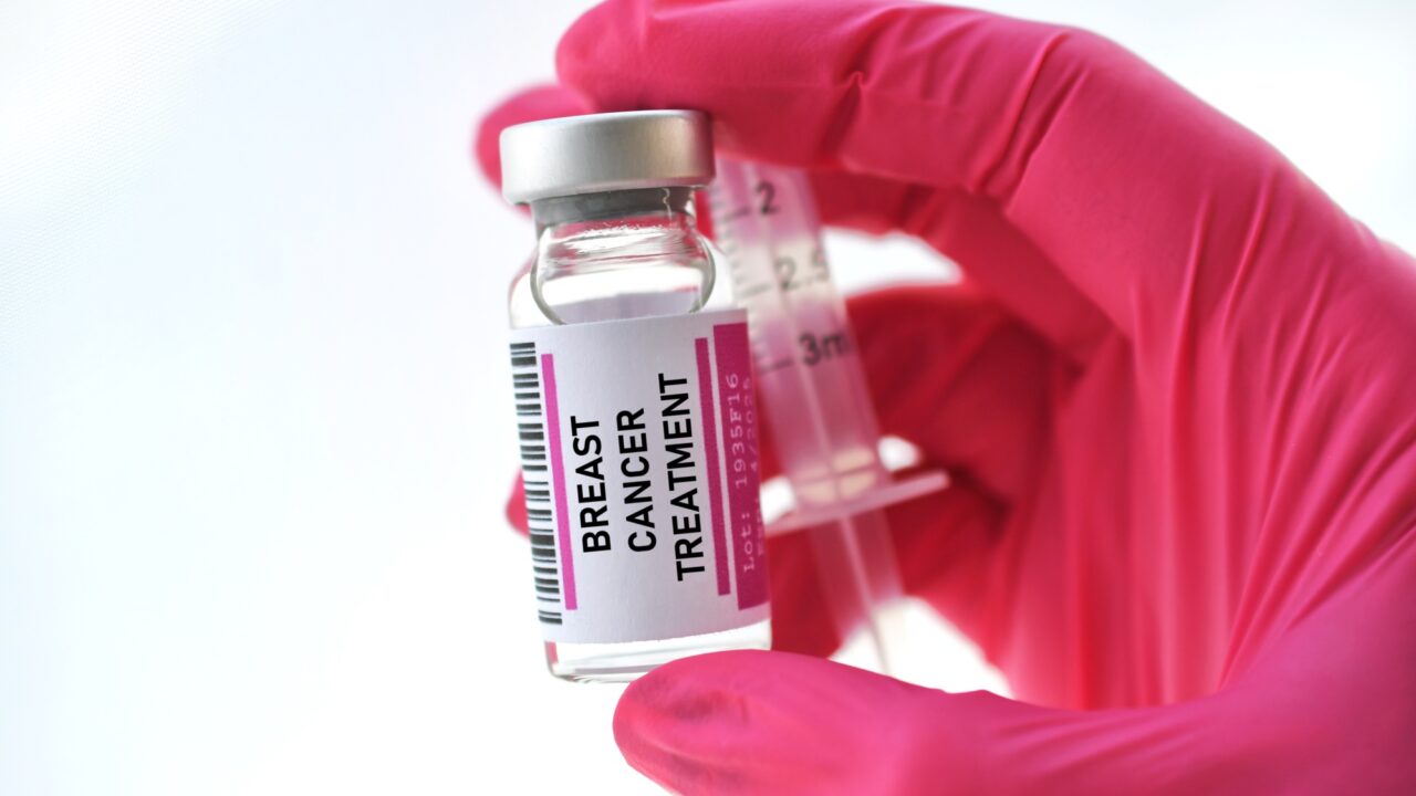 New biomarker predicts improved outcomes with dose-dense chemotherapy in ER-positive breast cancer