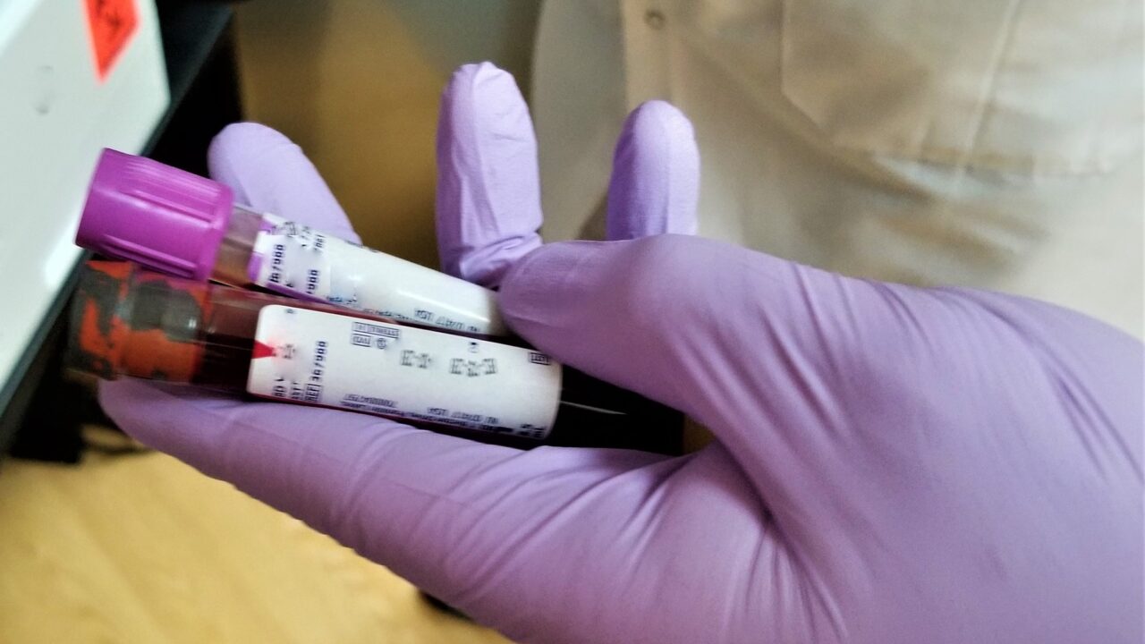 Novel combination provides more effective treatment option for mantle cell lymphoma