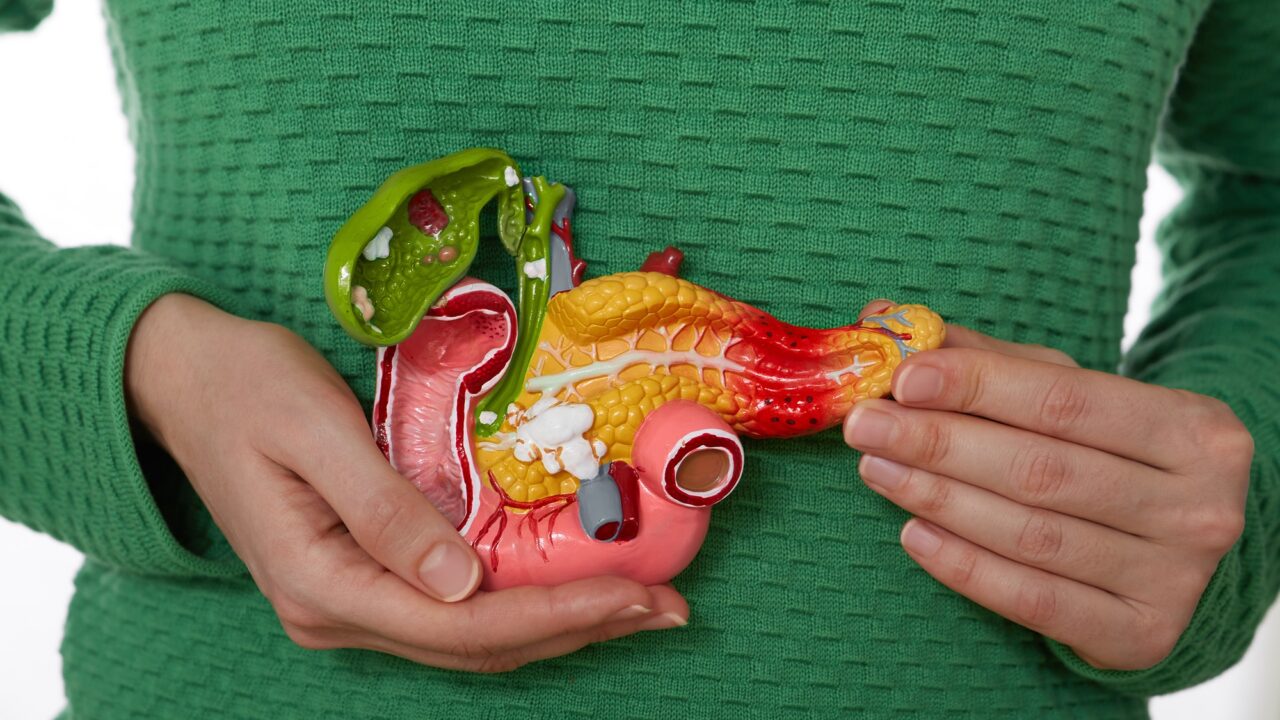 Comprehensive spatial map provides insights into pancreatic cancer metastases