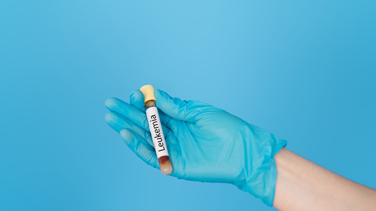 Triplet combinations improve outcomes for elderly patients with IDH-mutant AML