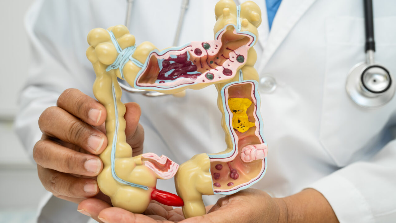 HER2-targeted therapy shows promising results in rare bile duct cancers