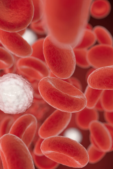 Antibody-drug conjugate achieves high response rates as frontline treatment in aggressive, rare blood cancer