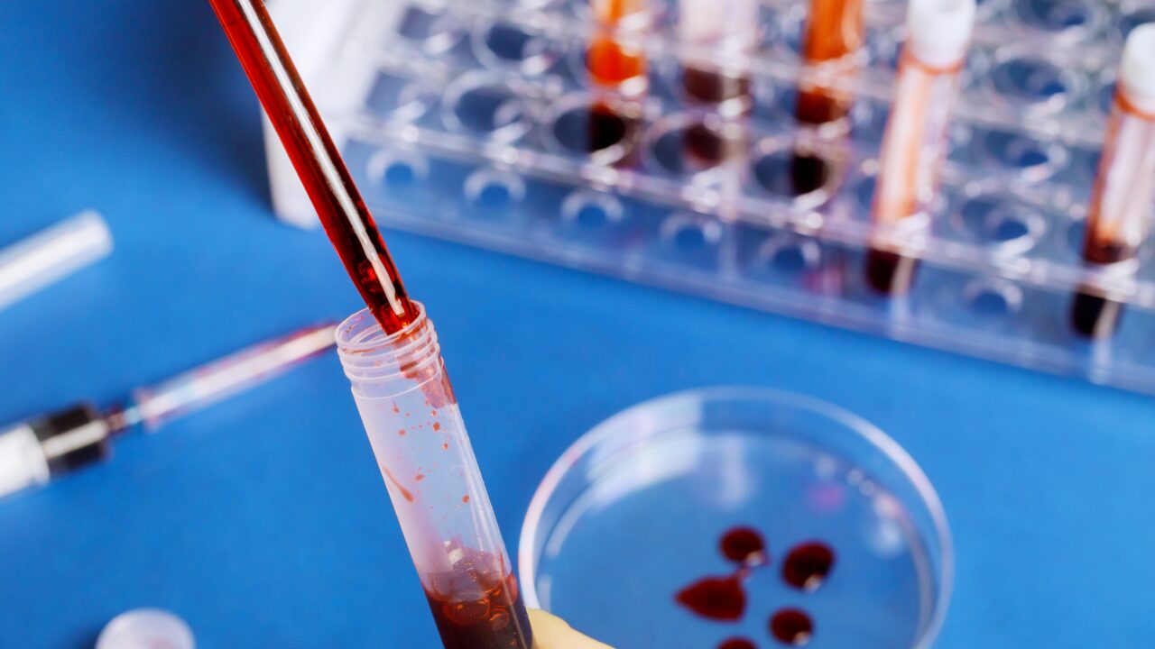 Scientists find blood-based biomarkers for inflammatory breast cancer